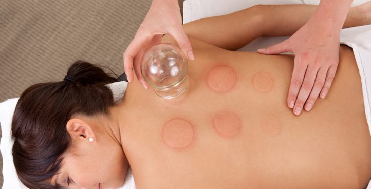 CuppIng Therapy (Bloodletting)