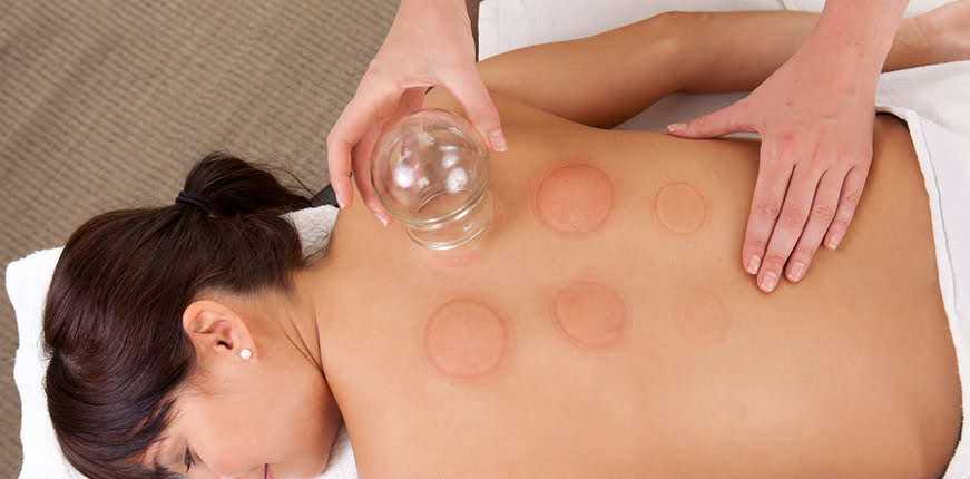 Cupping Therapy (Bloodletting)