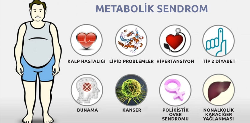 Fazla kilolar metabolik sendromun habercisi - Dr. Sinan Akkurt Fazla kilolar metabolik sendromun habercisi